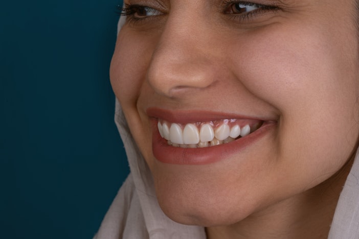 The 4-8-10 Rule for Veneers: How Many Do You Actually Need?