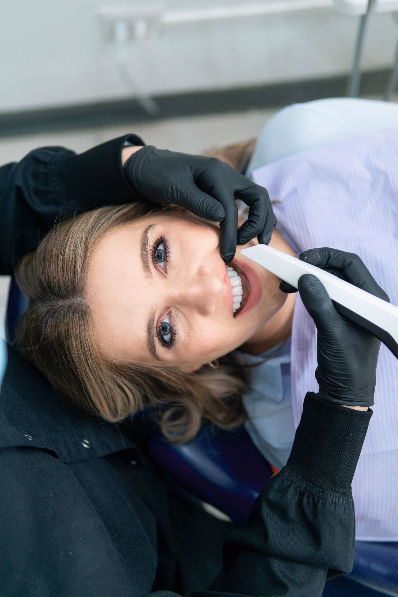 Composite Bonding Costs in the UK: What Determines the Price