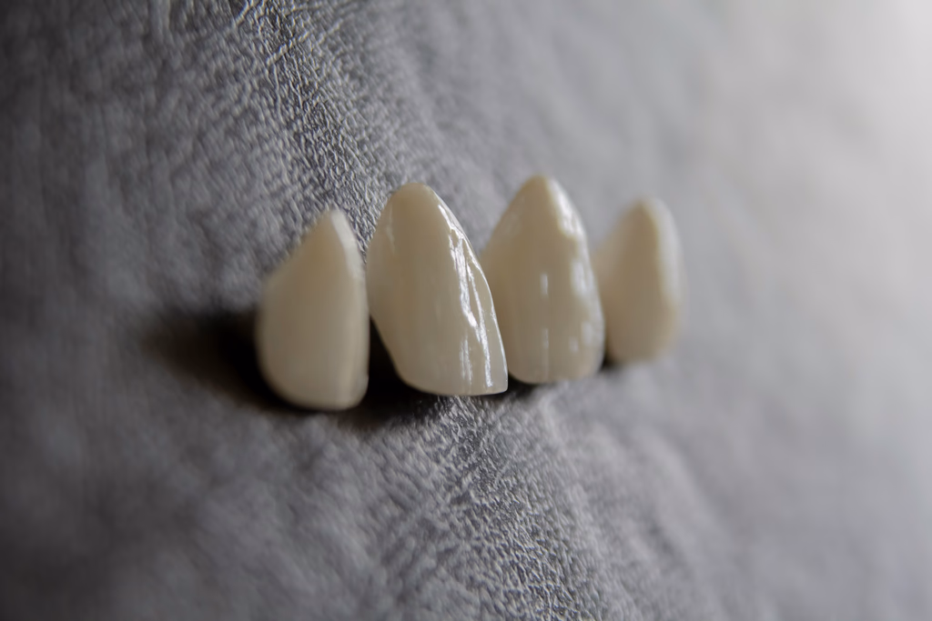 How Much a Dental Implant Costs in the UK
