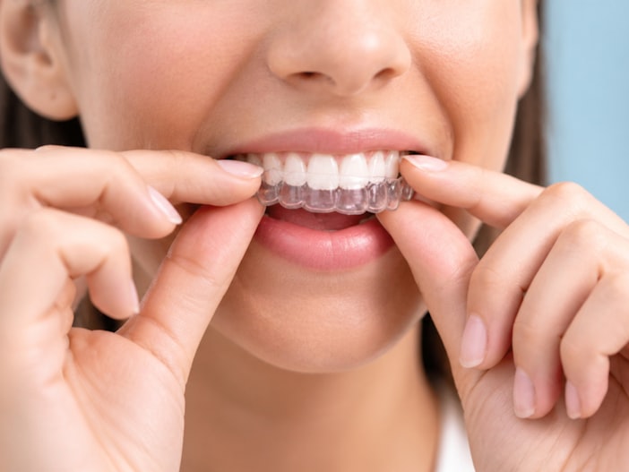 Is Invisalign Worth It? An Honest Answer, From £999