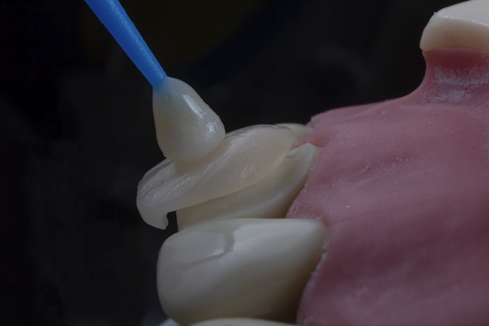 Lost a Filling? Here's What Actually Happens Next (And What It Costs)