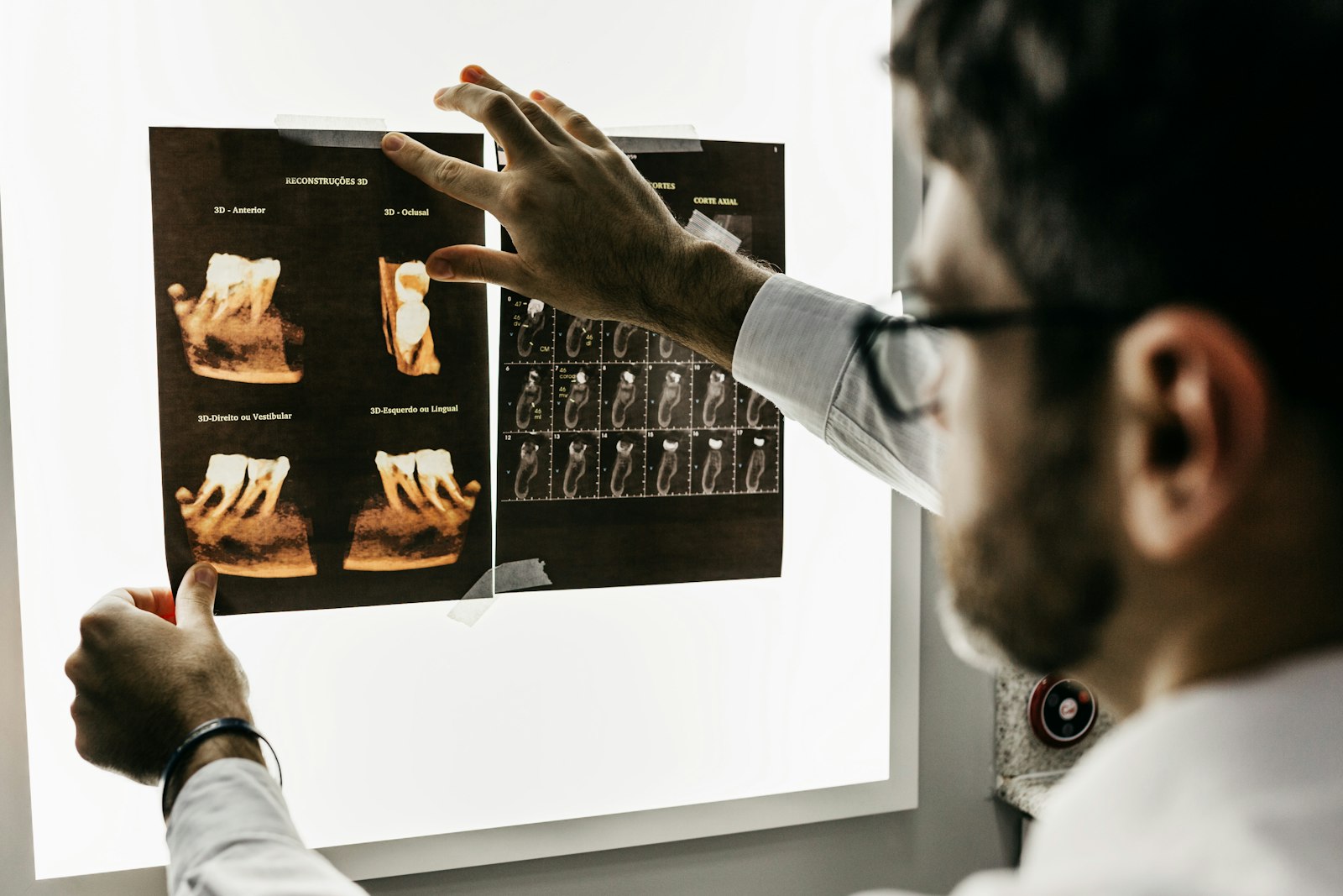 NHS Dentist Won't Do Your Root Canal? Here's Why and What to Do