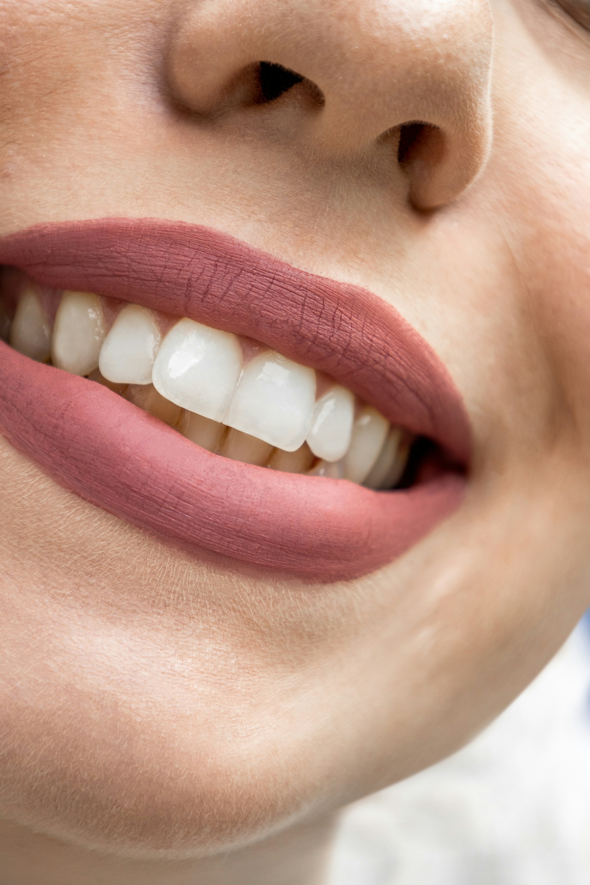 Teeth Whitening Cost UK 2026: £200-£700 Explained