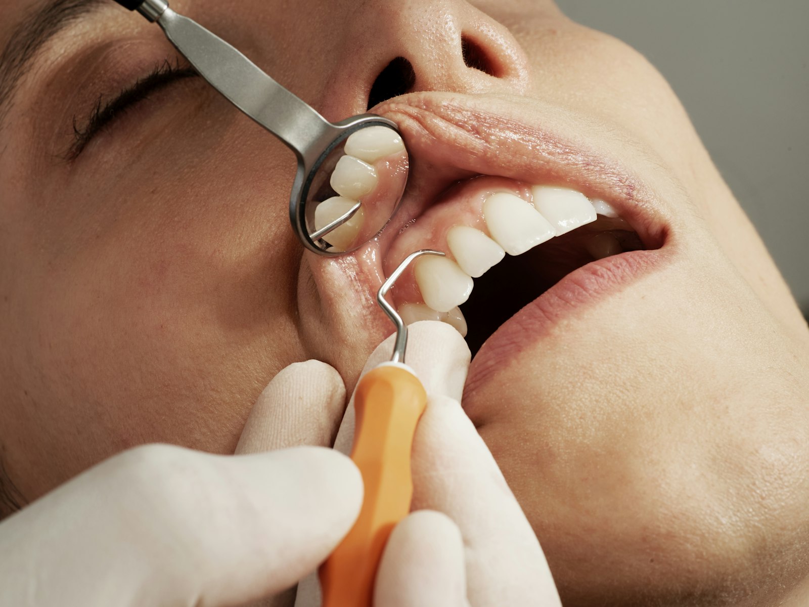2 Tooth Implant Cost UK: £3,998 for Two Teeth, Explained