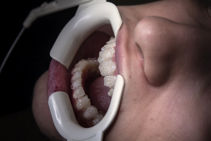 Wisdom Teeth Removal Recovery: A Day-by-Day Timeline of What to Expect