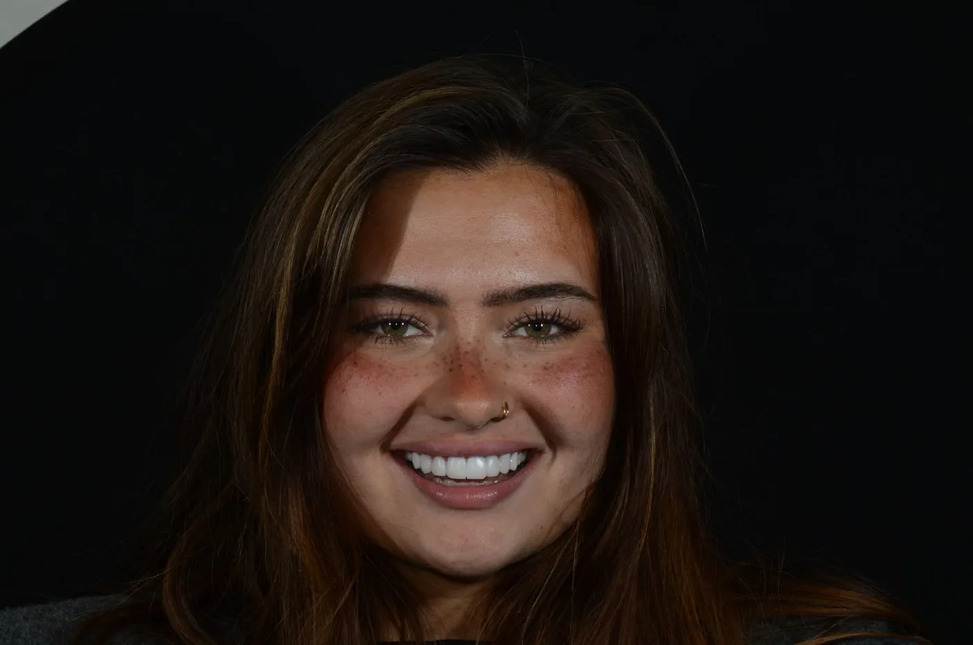The same patient after her treatment, smiling