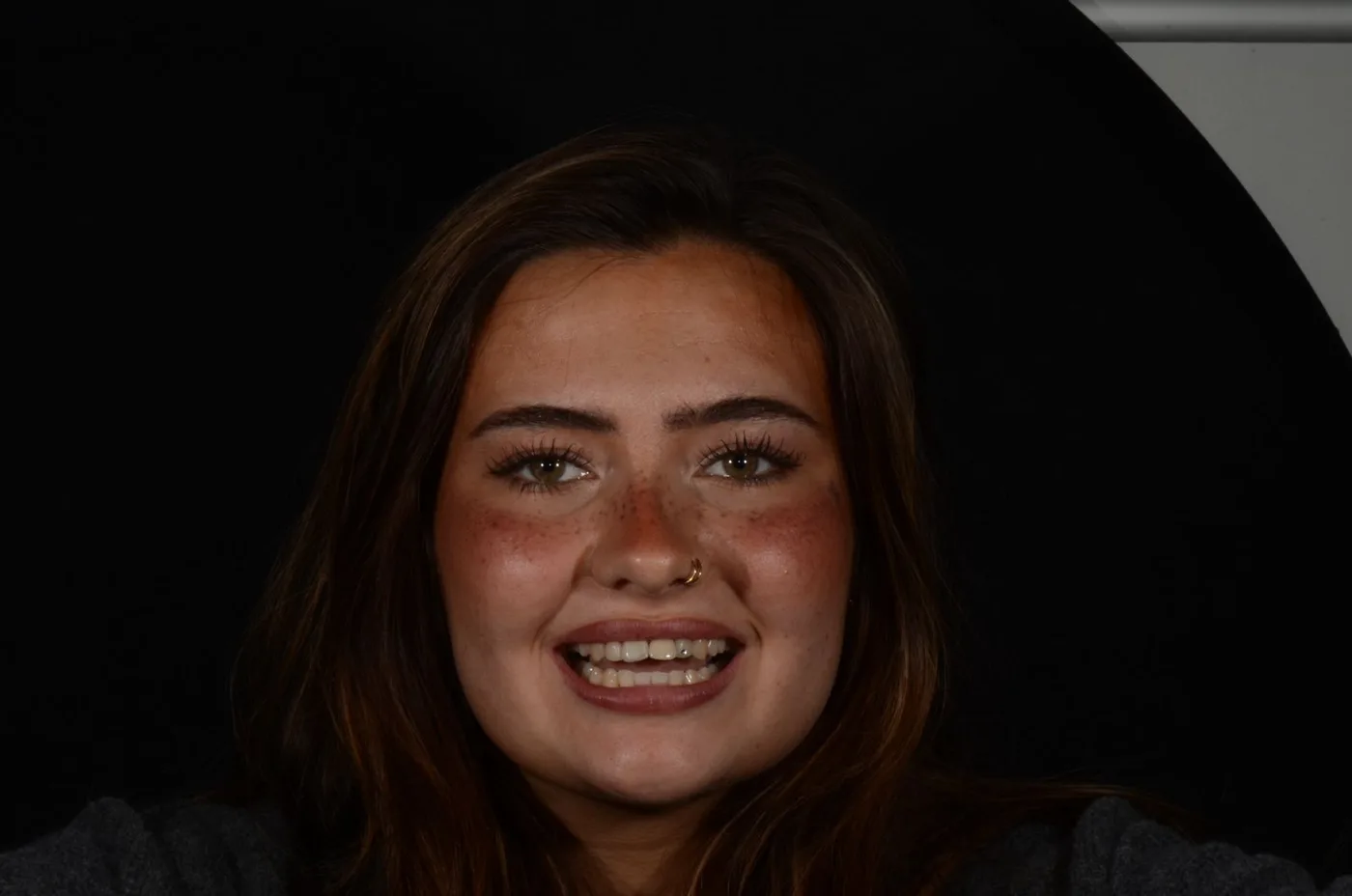 A patient before her smile treatment at UrgentCare Dental