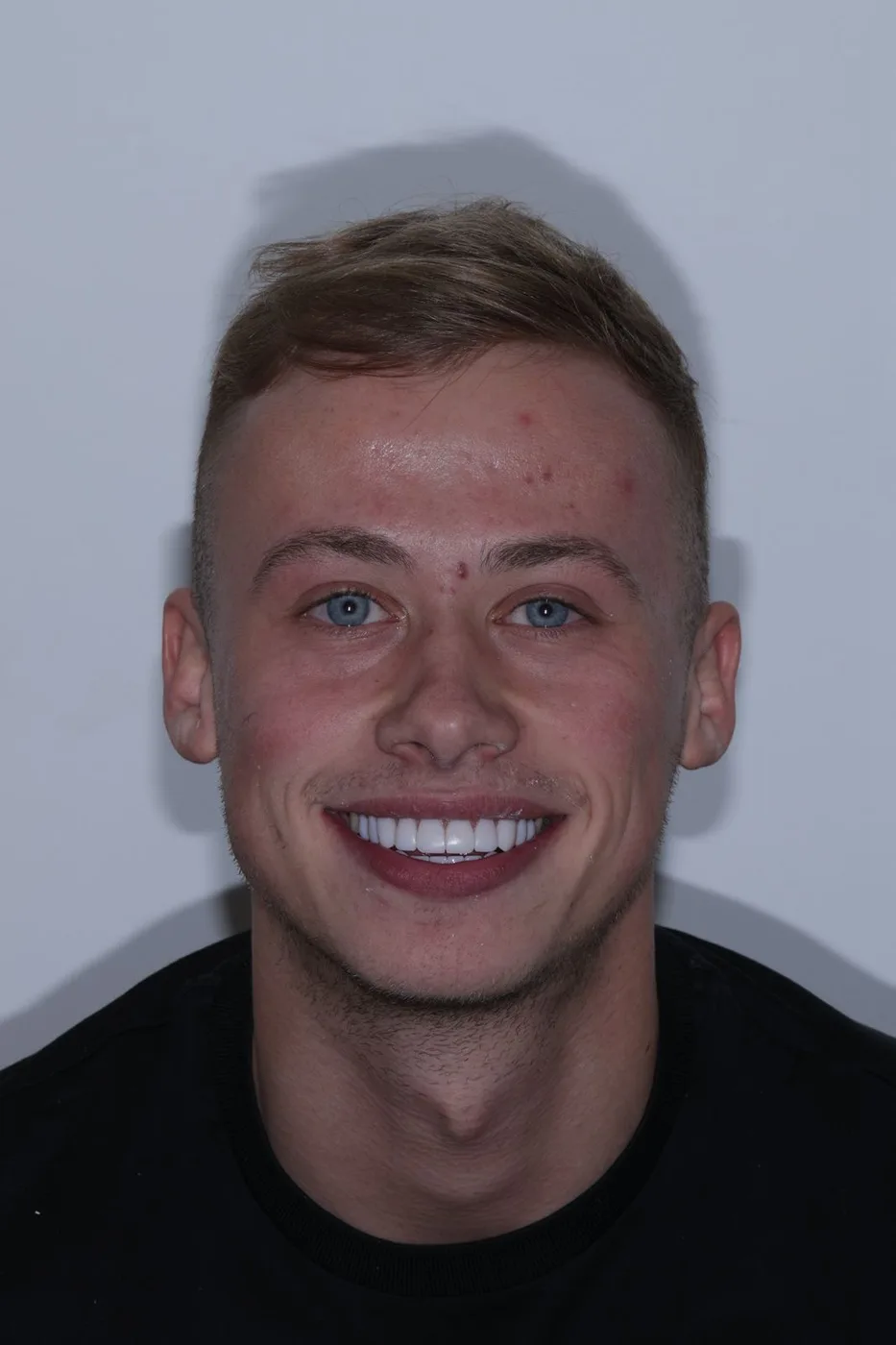 The same patient after his treatment, smiling