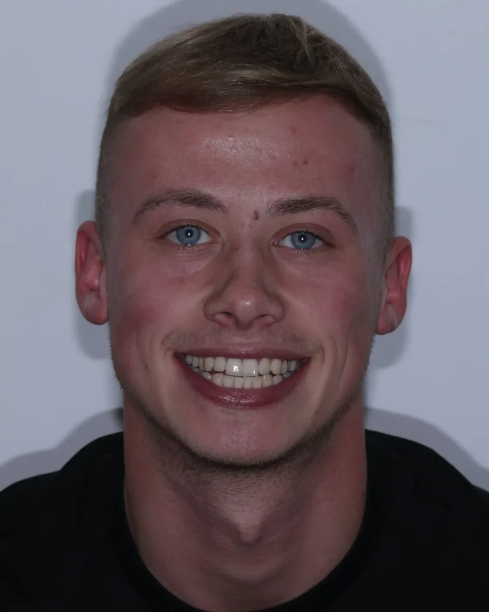 Our patient before his smile treatment