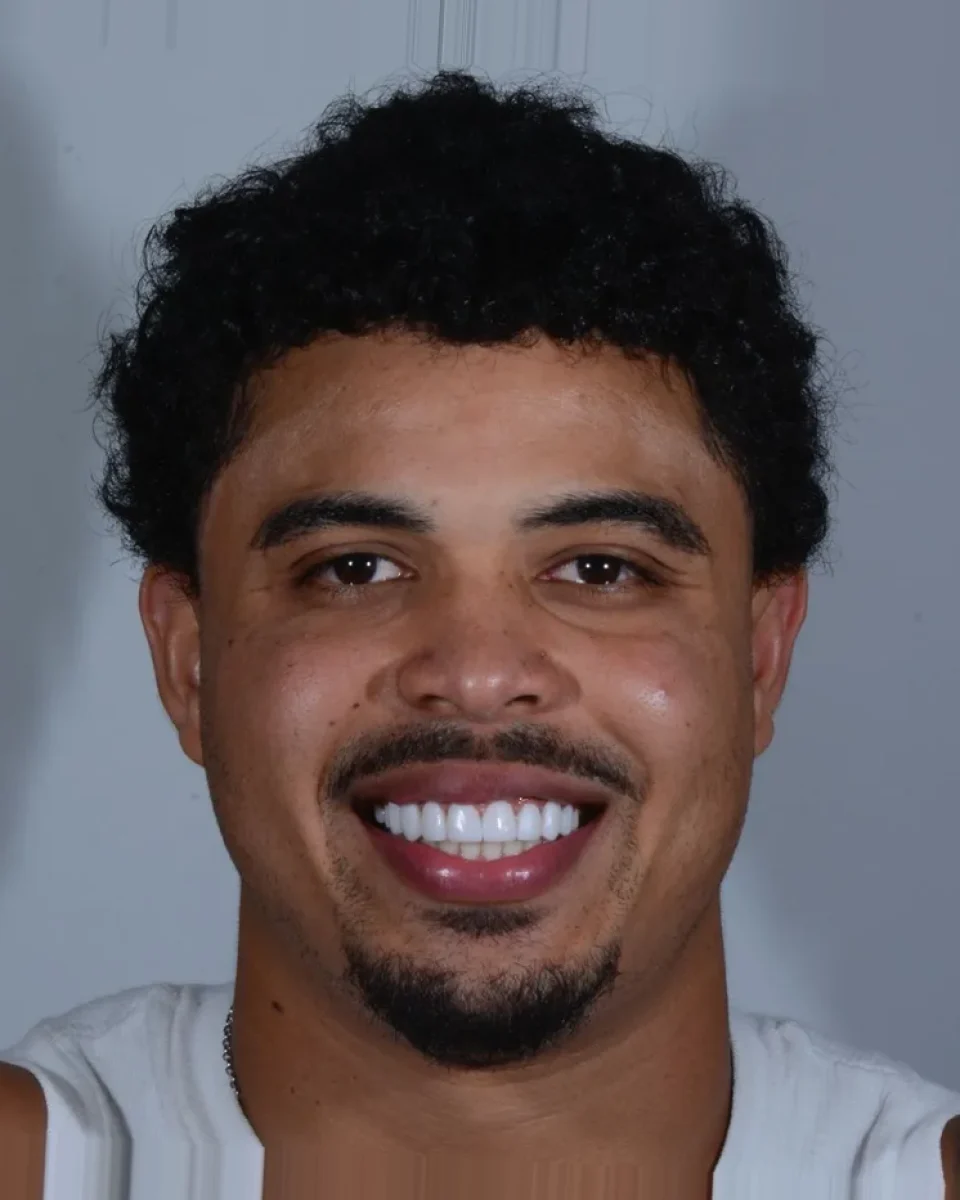 The same patient after his smile treatment, smiling