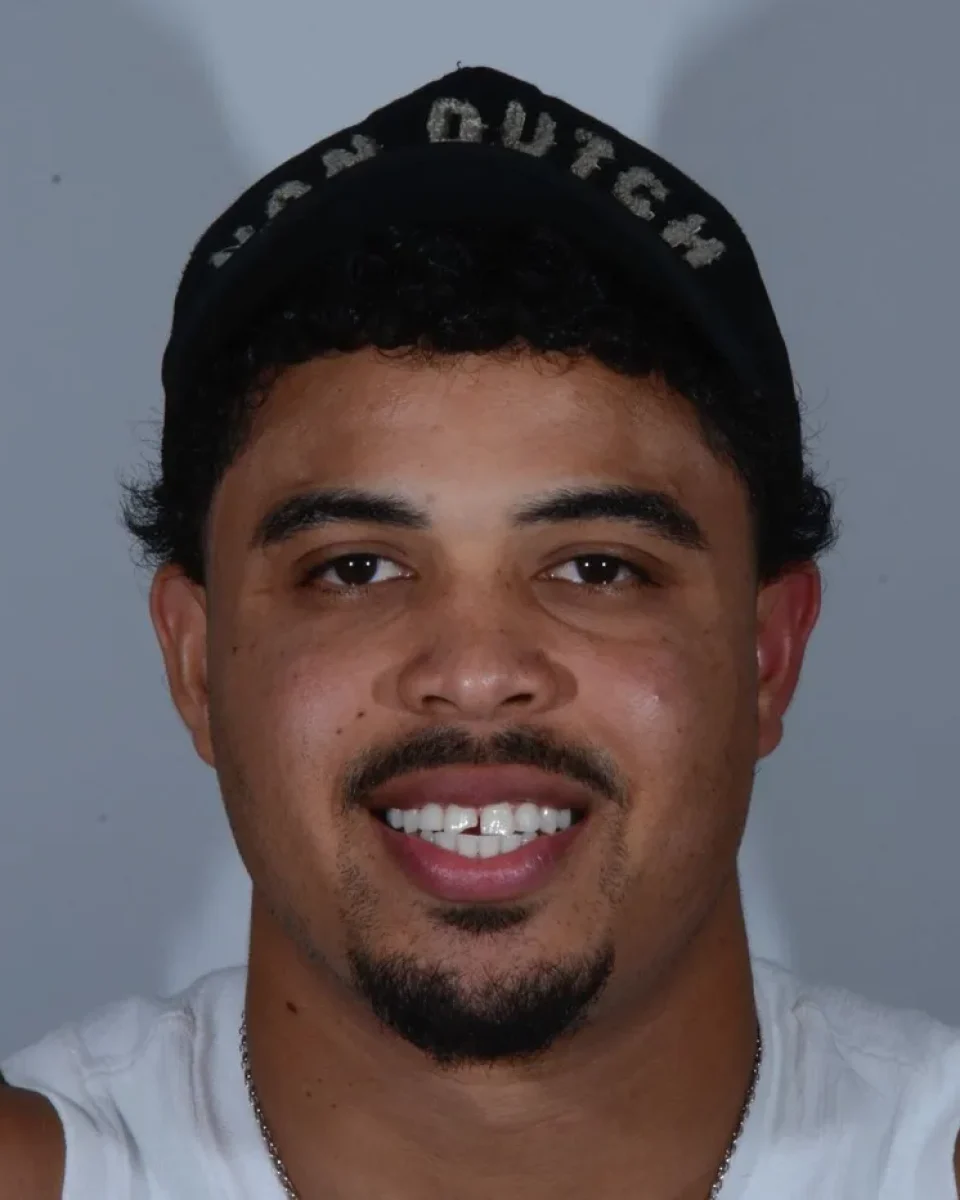 Our patient before his smile treatment