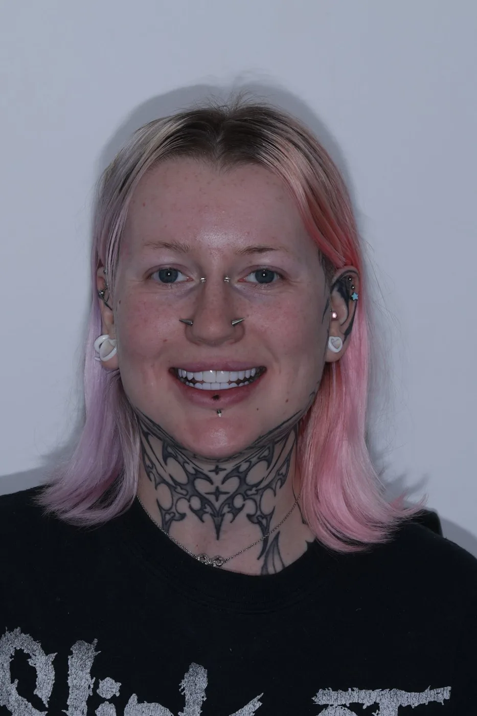The same patient after her treatment, smiling