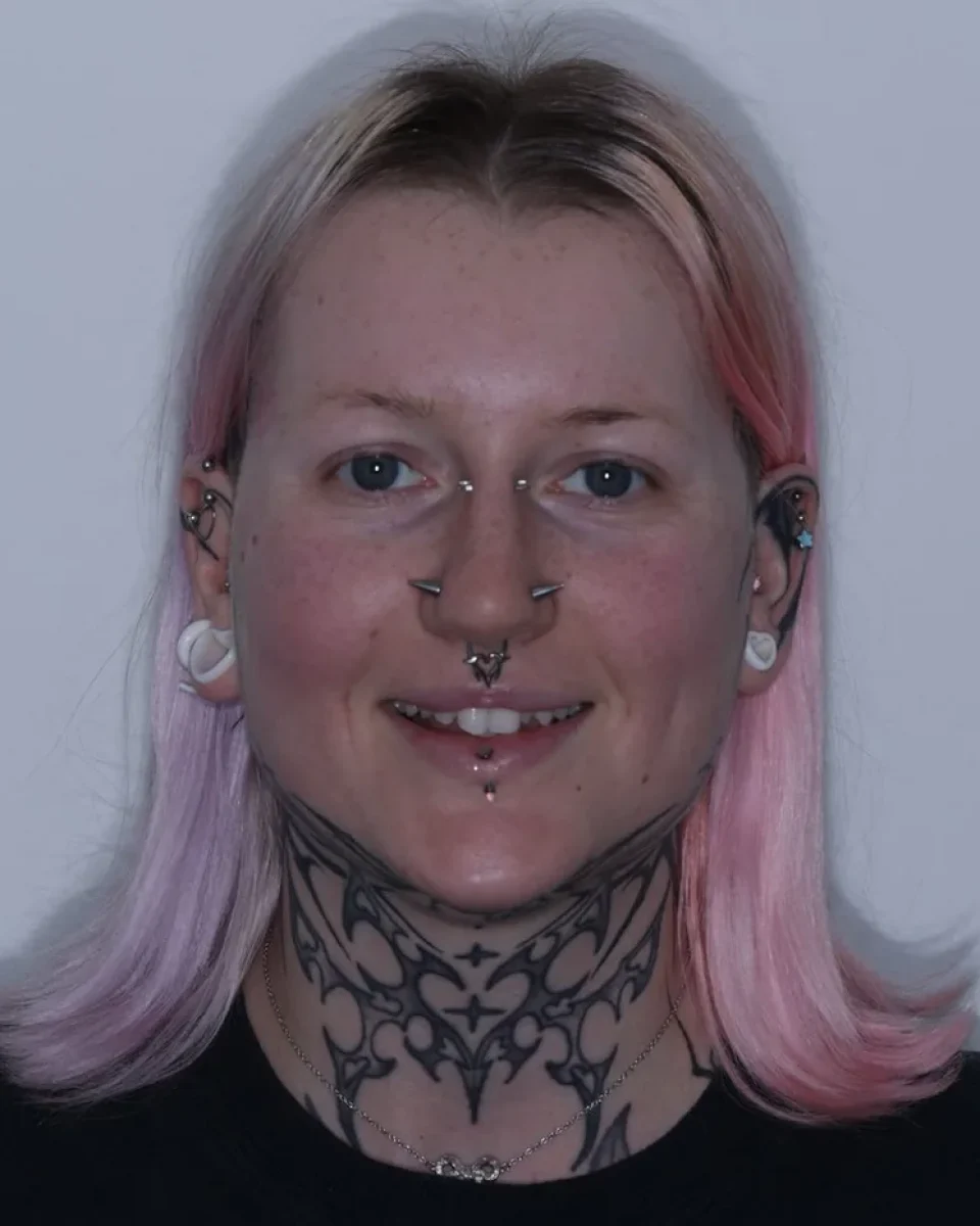 Our patient before her smile treatment