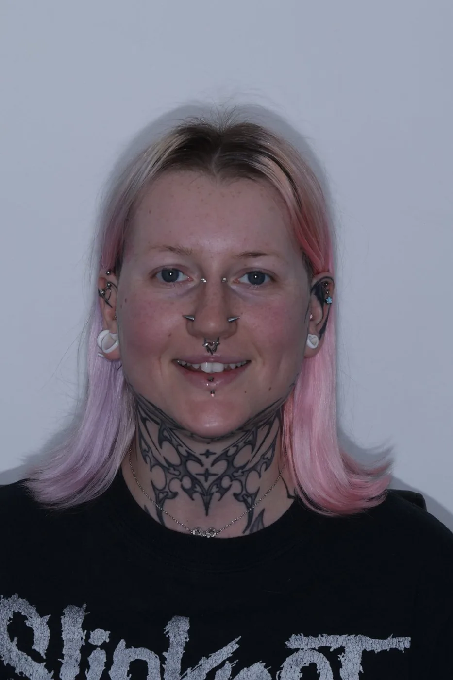 A patient before her smile treatment at UrgentCare Dental