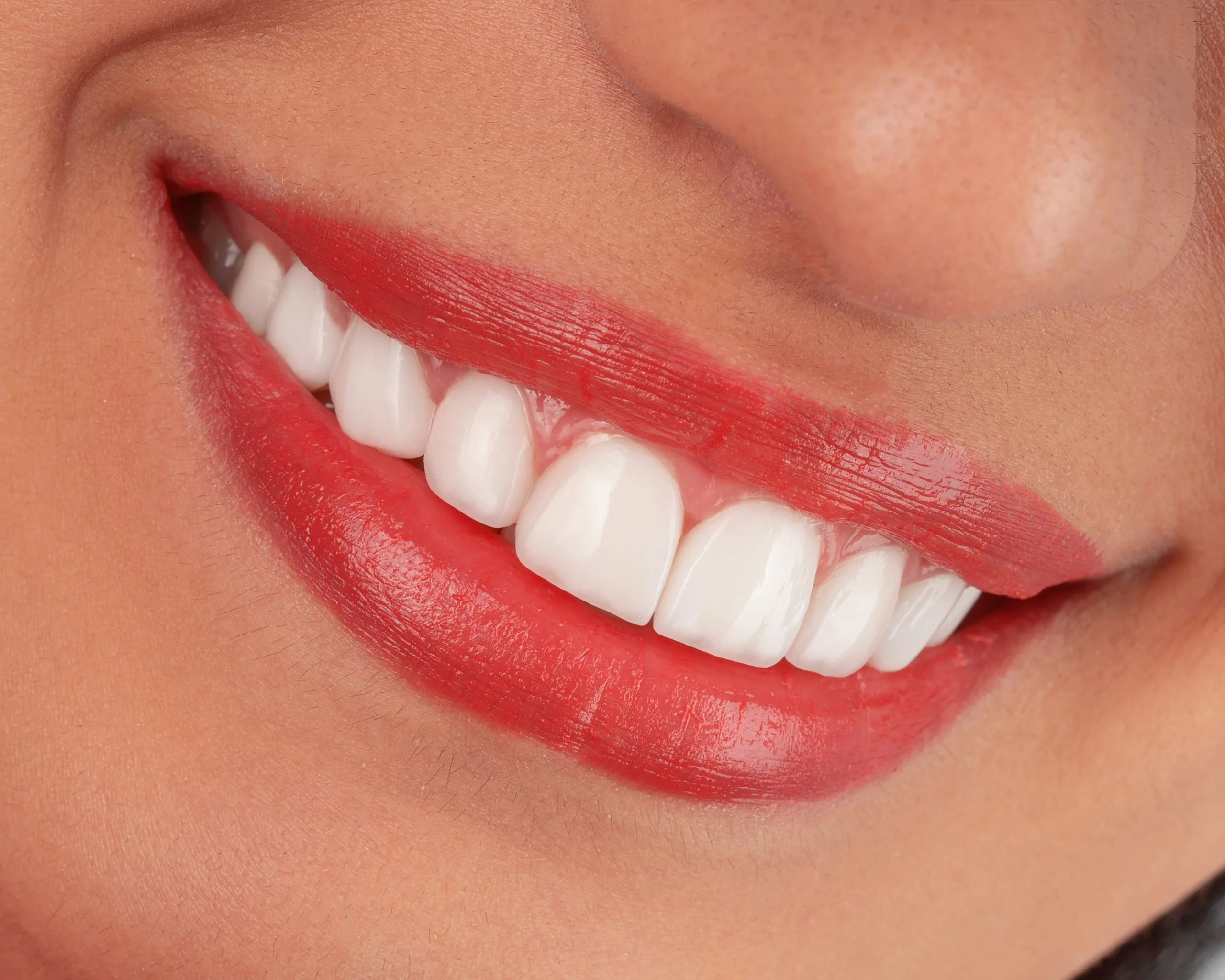 Smile makeover at UrgentCare Dental